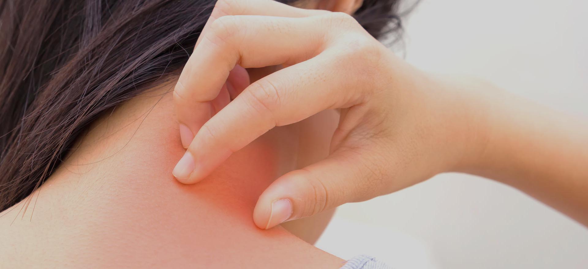 Botox treatment in Hazratganj Lucknow