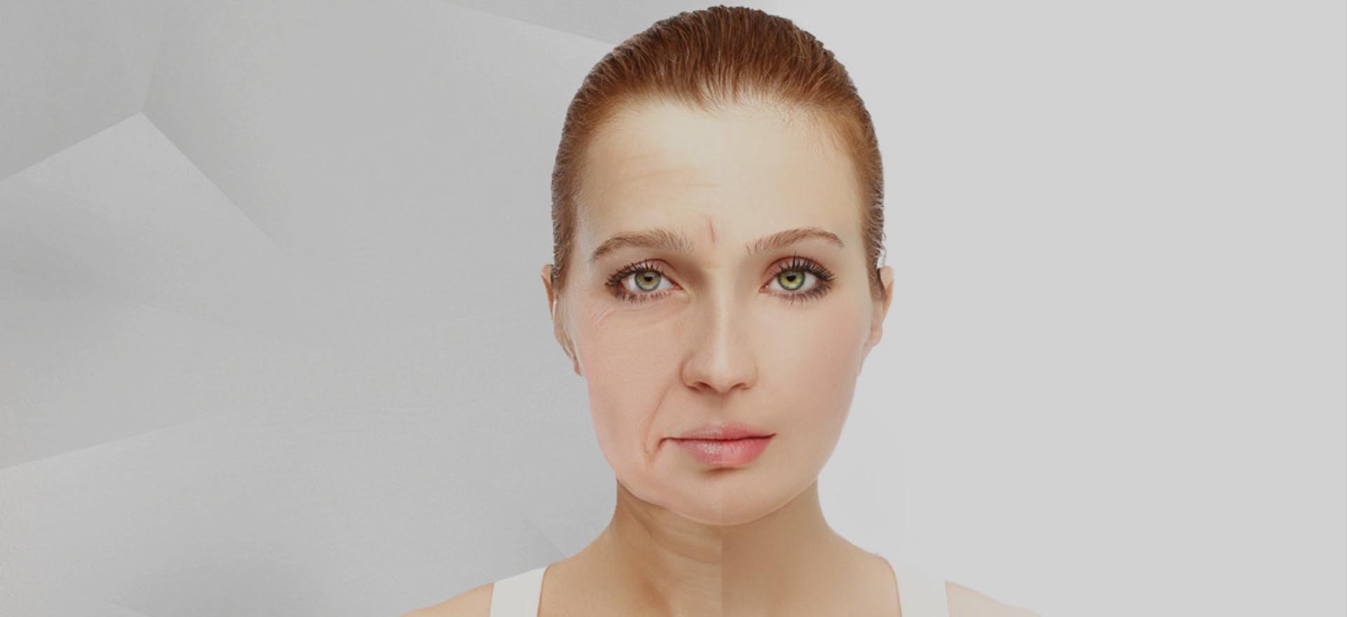 Filler treatment in Hazratganj Lucknow