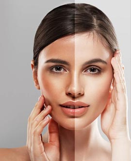 Botox treatment in Hazratganj Lucknow