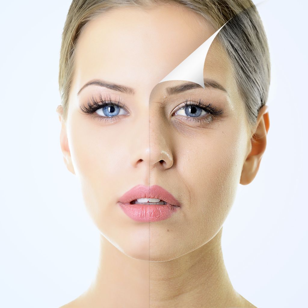Botox treatment in Hazratganj Lucknow