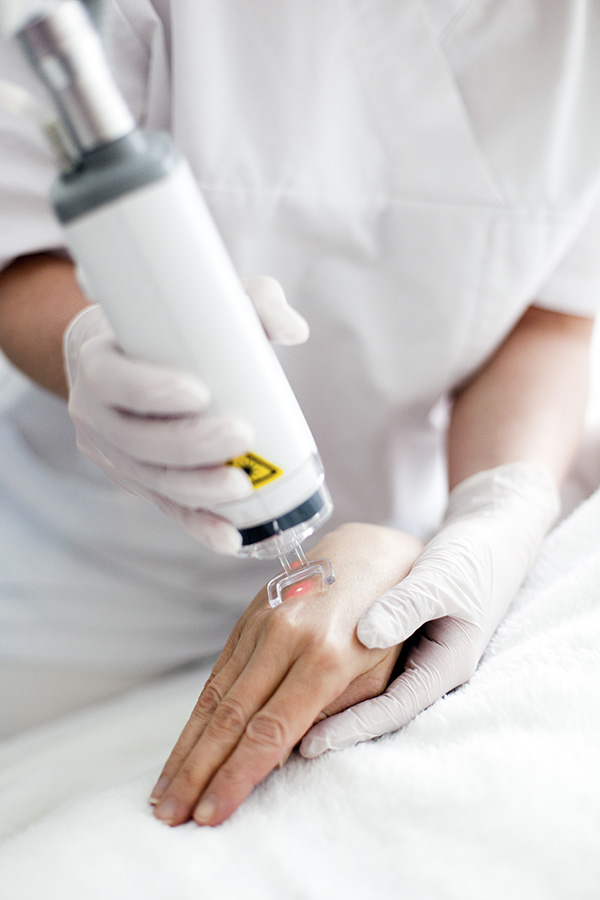 Laser skin treatment in Hazratganj Lucknow