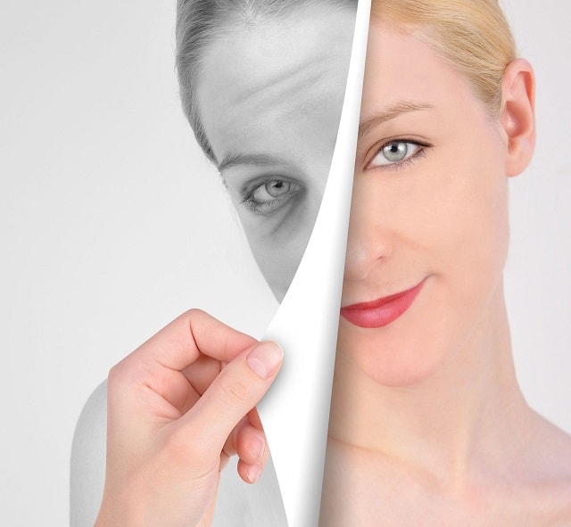 Filler treatment in Hazratganj Lucknow