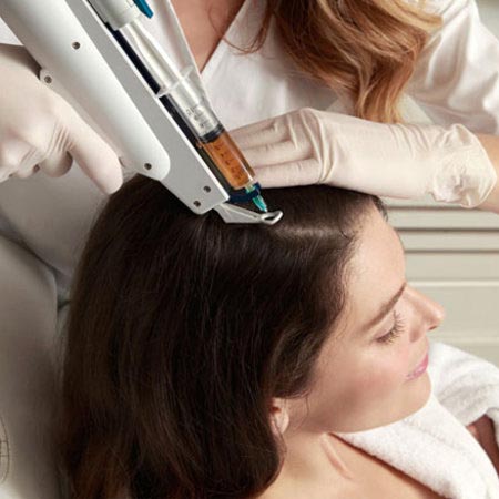 Hair transplant in Hazratganj Lucknow