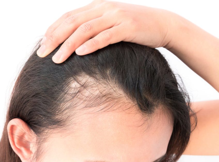Laser hair reduction in Hazratganj Lucknow