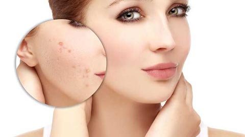 Hair transplant in Hazratganj Lucknow