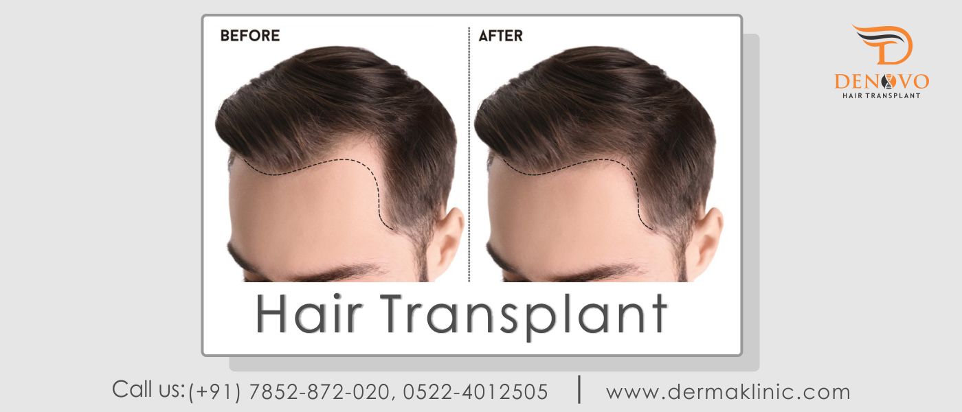 skin treatment in Hazratganj Lucknow
