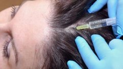 Filler treatment in Hazratganj Lucknow